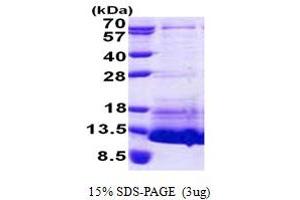 SDS-PAGE (SDS) image for Natriuretic Peptide Type C (NPPC) (AA 24-126) protein (His tag) (ABIN5853084)