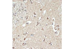 Immunohistochemistry of paraffin-embedded human brain using SR-B2/SR-B2/LIMPII Rabbit mAb (ABIN7270157) at dilution of 1:100 (40x lens). (SCARB2 Antikörper)