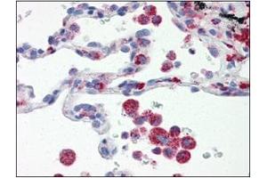 Immunohistochemistry (IHC) image for anti-Interferon Regulatory Factor 7 (IRF7) (AA 1-150), (N-Term) antibody (ABIN263915)