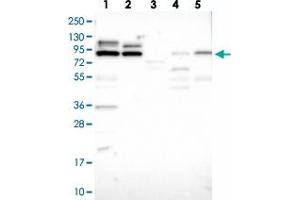 Western blot analysis of Lane 1: RT-4, Lane 2: U-251 MG, Lane 3: Human Plasma, Lane 4: Liver, Lane 5: Tonsil with LRRC68 polyclonal antibody  at 1:100-1:250 dilution.