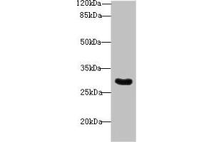 Western blot All lanes: Snrnp35 antibody at 12 μg/mL + Jurkat whole cell lysate Secondary Goat polyclonal to rabbit IgG at 1/10000 dilution Predicted band size: 29 kDa Observed band size: 29 kDa (SNRNP35 Antikörper  (AA 1-244))