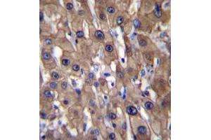Immunohistochemistry analysis in formalin fixed and paraffin embedded human liver tissue reacted with MAT1A Antibody (N-term) followed which was peroxidase conjugated to the secondary antibody and  followed by DAB staining.