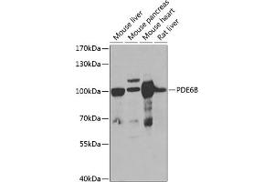 Western blot analysis of extracts of various cell lines, using PDE6B antibody (ABIN6132473, ABIN6145363, ABIN6145364 and ABIN6222688) at 1:1000 dilution. (PDE6B Antikörper  (AA 1-190))