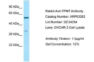 Western Blotting (WB) image for anti-Thiopurine S-Methyltransferase (TPMT) (C-Term) antibody (ABIN2789428)