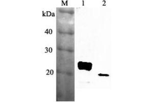 Western blot analysis using anti-RBP4 (mouse), pAb  at 1:2'000 dilution. (RBP4 Antikörper)