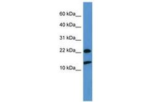 Image no. 1 for anti-Ribosomal Protein S27a (RPS27A) (AA 73-122) antibody (ABIN6746581) (RPS27A Antikörper  (AA 73-122))