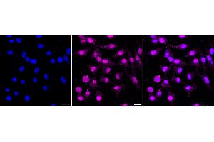 anti-Nucleoporin 107kDa (NUP107) antibody