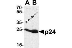 Western Blotting (WB) image for anti-Human Immunodeficiency Virus 1 Capsid (HIV-1 p24) antibody (ABIN1077455)