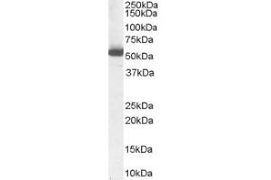 Image no. 1 for anti-Aldehyde Dehydrogenase 1 Family, Member A1 (ALDH1A1) (Internal Region) antibody (ABIN374658) (ALDH1A1 Antikörper  (Internal Region))