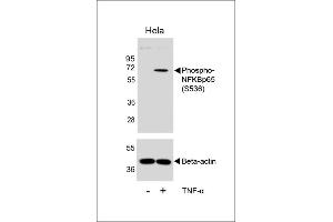 Western blot analysis of lysates from Hela cell line, untreated or treated with TNF-α, 20 ng/mL, using Phospho-NFKBp65 Antibody  (upper) or Beta-actin (lower). (NFkB Antikörper  (pSer536))