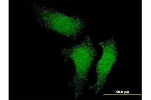 Immunofluorescence of monoclonal antibody to RUVBL1 on HeLa cell. (RUVBL1 Antikörper  (AA 1-456))
