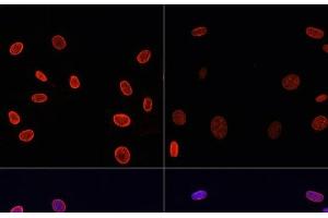 Immunofluorescence analysis of NIH/3T3 cells using Acetyl-Histone H4-K91 Polyclonal Antibody at dilution of 1:100. (Histone H4 Antikörper  (acLys91))
