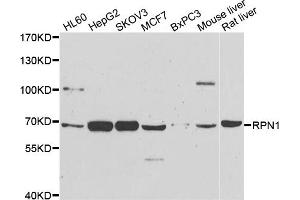 Western blot analysis of extracts of various cell lines, using RPN1 antibody. (RPN1 Antikörper)