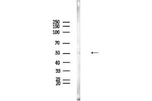anti-Dyslexia Susceptibility 1 Candidate 1 (DYX1C1) antibody