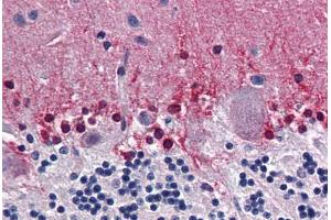Human Brain, Cerebellum: Formalin-Fixed, Paraffin-Embedded (FFPE) (CBS Antikörper  (AA 1-101))