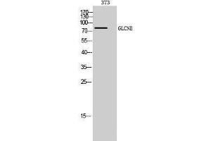 Western Blotting (WB) image for anti-Glucosamine (UDP-N-Acetyl)-2-Epimerase/N-Acetylmannosamine Kinase (GNE) (C-Term) antibody (ABIN3184799) (GNE Antikörper  (C-Term))
