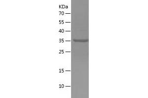 Western Blotting (WB) image for Myosin, Light Chain 1, Alkali, Skeletal, Fast (MYL1) (AA 1-150) protein (His-IF2DI Tag) (ABIN7282499) (MYL1 Protein (AA 1-150) (His-IF2DI Tag))