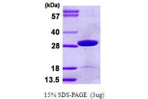 Thiamin Pyrophosphokinase 1 (TPK1) (AA 1-243) protein (His tag)