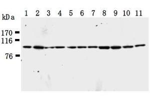 Western Blotting (WB) image for anti-Karyopherin (Importin) beta 1 (KPNB1) antibody (ABIN1449199)