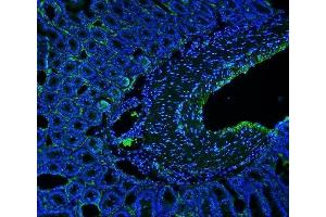 IF analysis of MCAM using anti-MCAM antibody (ABIN7601026).