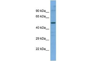 Host:  Rabbit  Target Name:  SLC5A7  Sample Type:  ACHN Whole Cell lysates  Antibody Dilution:  1. (ChT Antikörper  (C-Term))