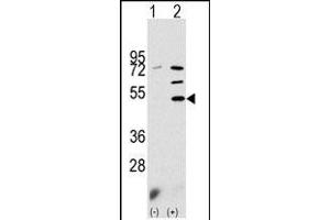Western blot analysis of PDK3 (arrow) using rabbit polyclonal PDK3 Antibody (N-term) (ABIN391038 and ABIN2841204). (PDK3 Antikörper  (N-Term))