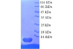 SDS-PAGE (SDS) image for Chemokine (C-C Motif) Ligand 18 (Pulmonary and Activation-Regulated) (CCL18) (AA 21-89) protein (His tag) (ABIN7478953)
