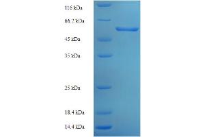 SDS-PAGE (SDS) image for Alanine Glyoxylate Aminotransferase (AGXT) (AA 25-414) protein (His-SUMO Tag) (ABIN5709015) (AGXT Protein (AA 25-414) (His-SUMO Tag))