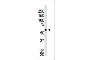 The anti-BACE2C C-term Pab (ABIN390057 and ABIN2837930) is used in Western blot to detect BACE2C in A549 cell lysate. (BACE2C Antikörper  (C-Term))