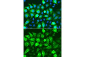 Immunofluorescence analysis of A549 cells using RRM2 antibody. (RRM2 Antikörper)