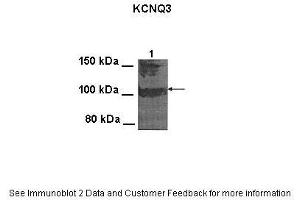 Lanes:   100 ug CHO cell lysate  Primary Antibody Dilution:   1:1000  Secondary Antibody:   Goat anti-rabbit HRP  Secondary Antibody Dilution:   1:25000  Gene Name:   Kcnq3  Submitted by:   Anonymous (KCNQ3 Antikörper  (Middle Region))