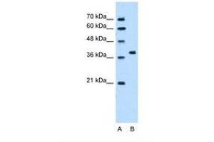Image no. 2 for anti-RUN Domain Containing 2A (RUNDC2A) (N-Term) antibody (ABIN321330) (SNX29 Antikörper  (N-Term))