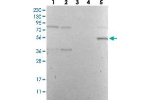 Western Blot analysis with DES polyclonal antibody  Lane 1: Human cell line RT-4 Lane 2: Human cell line U-251MG sp Lane 3: Human plasma (IgG/HSA depleted) Lane 4: Human liver tissue Lane 5: Human tonsil tissue (Desmin Antikörper)