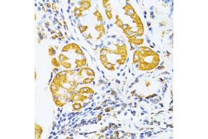Immunohistochemistry of paraffin-embedded human stomach using MMP2 antibody (ABIN1882374) at dilution of 1:100 (40x lens). (MMP2 Antikörper)