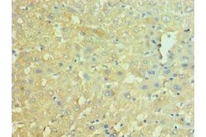 Immunohistochemistry of paraffin-embedded human liver tissue using ABIN7161572 at dilution of 1:100 (NAMPT Antikörper  (AA 1-280))