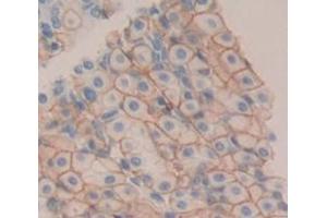 Used in DAB staining on fromalin fixed paraffin- embedded Kidney tissue (TREM2 Antikörper  (AA 1-228))