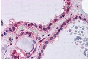 Human Thyroid: Formalin-Fixed, Paraffin-Embedded (FFPE) (Hepcidin Antikörper  (AA 25-85))