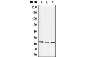 Western blot analysis of LMX1B expression in HeLa (A), Jurkat (B), SP2/0 (C) whole cell lysates.