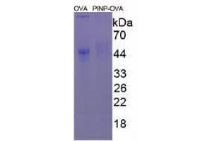 Image no. 2 for Procollagen I N-Terminal Propeptide (PINP) (N-Term) peptide (Ovalbumin) (ABIN5666347) (Procollagen I N-Terminal Propeptide (PINP) (N-Term) peptide (Ovalbumin))
