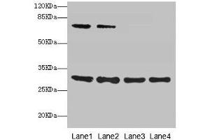 Western blot All lanes: SPIN3 antibody at 6 μg/mL Lane 1: A549 whole cell lysate Lane 2: Hela whole cell lysate Lane 3: A431 whole cell lysate Lane 4: HepG2 whole cell lysate Secondary Goat polyclonal to rabbit IgG at 1/10000 dilution Predicted band size: 30, 9 kDa Observed band size: 30, 70 kDa (SPIN3 Antikörper  (AA 1-77))