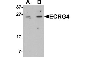 Western blot analysis of ECRG4 in HeLa cell lysate with ECRG4 antibody at (A) 1 and (B) 2 µg/mL. (C2orf40 Antikörper  (C-Term))