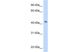 Western Blotting (WB) image for anti-Melanoma Antigen Family A, 1 (Directs Expression of Antigen MZ2-E) (MAGEA1) antibody (ABIN2462943) (MAGEA1 Antikörper)