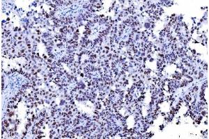 IHC analysis of MSH2 using anti-MSH2 antibody (ABIN7601369). (MSH2 Antikörper  (AA 337-583))