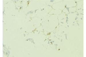 ABIN6276695 at 1/100 staining Human lung tissue by IHC-P. (Adiponectin Receptor 1 Antikörper  (C-Term))