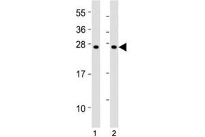 Western Blotting (WB) image for anti-Suppressor of Cytokine Signaling 1 (SOCS1) (AA 35-66) antibody (ABIN3029042)