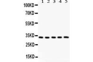 Anti-HSD11B1  antibody, Western blottingAll lanes: All lanes: Anti HSD11B1  at 0. (HSD11B1 Antikörper  (N-Term))