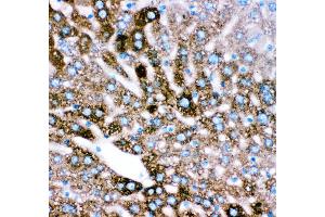 Immunohistochemistry (IHC) image for anti-Cytochrome P450, Family 2, Subfamily E, Polypeptide 1 (CYP2E1) (AA 1-310) antibody (ABIN3043821)