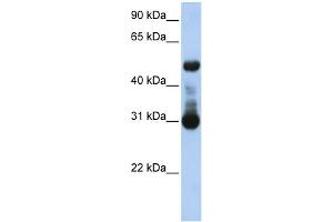 WB Suggested Anti-ACVRL1 Antibody Titration:  0. (ACVRL1 Antikörper  (N-Term))