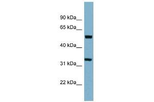 TMEM158 antibody used at 1 ug/ml to detect target protein.