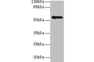 Western blot All lanes: RBMY1F antibody at 2 μg/mL + PC-3 whole cell lysate Secondary Goat polyclonal to rabbit IgG at 1/10000 dilution Predicted band size: 56, 48 kDa Observed band size: 56 kDa (RBMY1F Antikörper  (AA 1-496))